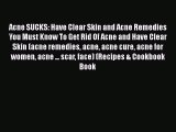 Read Acne SUCKS: Have Clear Skin and Acne Remedies You Must Know To Get Rid Of Acne and Have