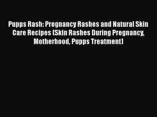 Download Pupps Rash: Pregnancy Rashes and Natural Skin Care Recipes (Skin Rashes During Pregnancy