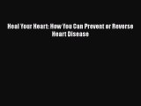Read Heal Your Heart: How You Can Prevent or Reverse Heart Disease Ebook Free