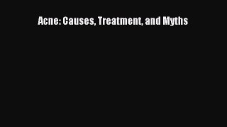 Read Acne: Causes Treatment and Myths Ebook Free
