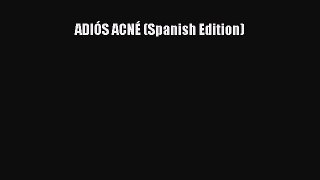 Read ADIÓS ACNÉ (Spanish Edition) PDF Online