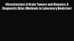[PDF] Ultrastructure of Brain Tumors and Biopsies: A Diagnostic Atlas (Methods in Laboratory