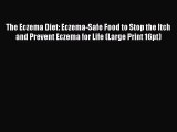 Read The Eczema Diet: Eczema-Safe Food to Stop the Itch and Prevent Eczema for Life (Large