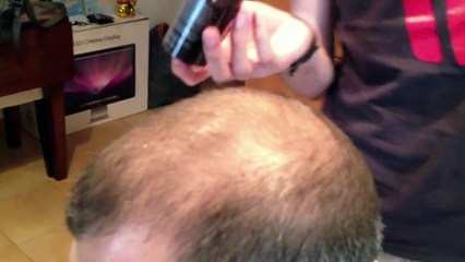 Elle met un produit sur la tête chauve de son ami, ce qui passe quelques minutes après est éblouissant !