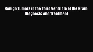 Download Benign Tumors in the Third Ventricle of the Brain: Diagnosis and Treatment  EBook