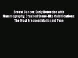 PDF Breast Cancer: Early Detection with Mammography: Crushed Stone-like Calcifications: The