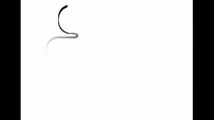 Vet Rocks Puppy Like A Baby To Calm Her After Surgery