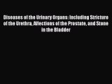 [PDF] Diseases of the Urinary Organs: Including Stricture of the Urethra Affections of the