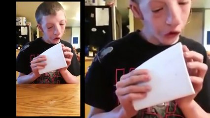 Ce garçon a été opéré 53 fois