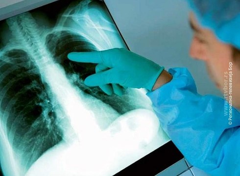 Svetski dan borbe protiv tuberkuloze, 24. mart 2016. (RTV Bor)