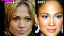 Jennifer Lopez vor Plastische Chirurgie und ohne make-up auf