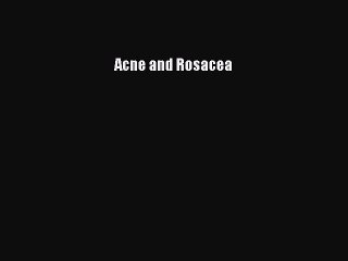 Download Acne and Rosacea Free Books