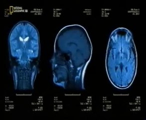 Neuroteologia: La idea de Dios (Dibujos, Andrew Newberg)