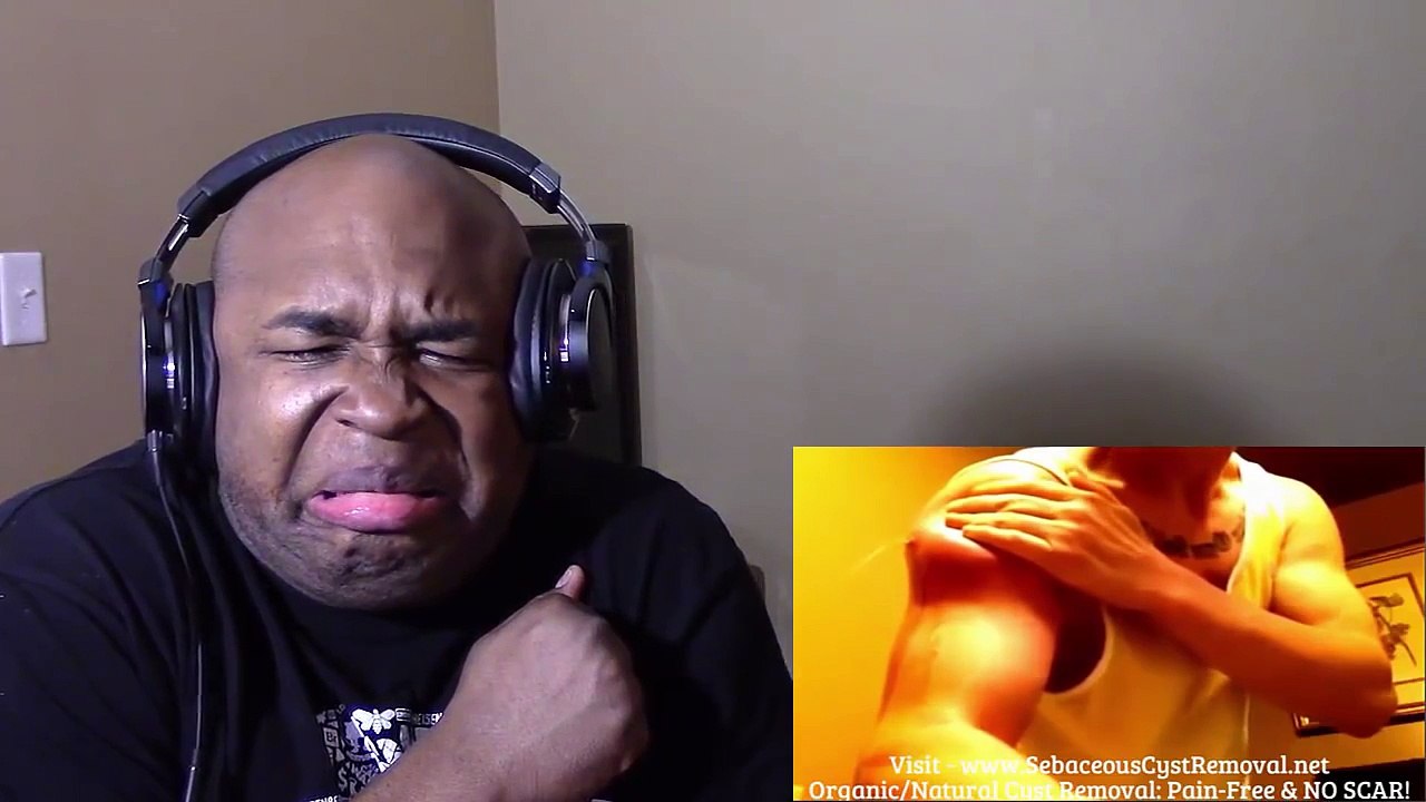 Guiness Worlds Record GROSSEST Cyst/Boil Ever REACTION