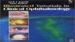 Download Illustrated Tutorials in Clinical Ophthalmology with CD ROM  1e
