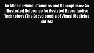 Read An Atlas of Human Gametes and Conceptuses: An Illustrated Reference for Assisted Reproductive