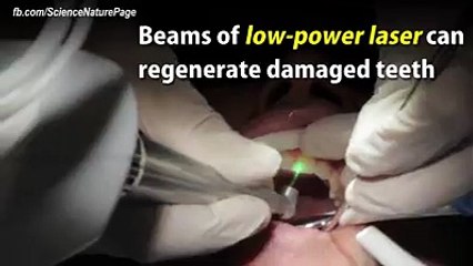 Le laser peut effectivement répararer les dents endommagées