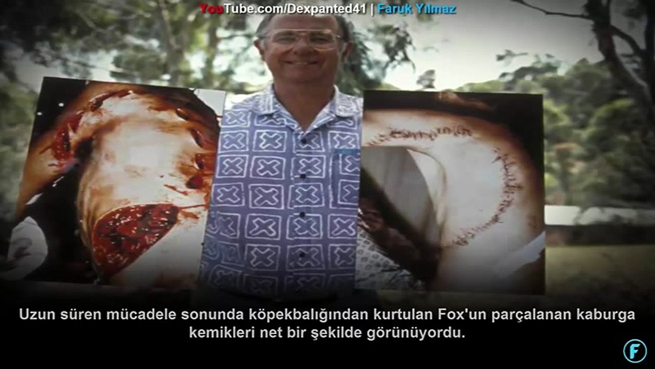 5 İnanılmaz Köpekbalığı Saldırı Hikayesi(1)