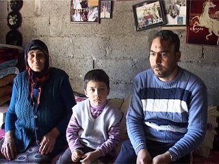 Kafatasının bir kısmı olmadan yaşayan vatandaş yardım bekliyor