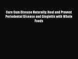 Download Cure Gum Disease Naturally: Heal and Prevent Periodontal Disease and Gingivitis with