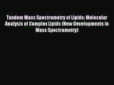 Read Tandem Mass Spectrometry of Lipids: Molecular Analysis of Complex Lipids (New Developments