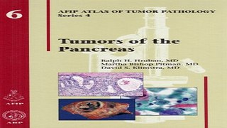 Download Tumors of the Pancreas  Afip Atlas of Tumor Pathology  4th Series Fascicle 6