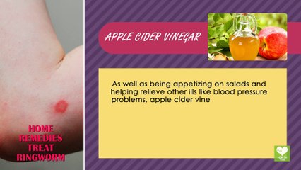 Ringworm - Home Remedies | Valvetta Mcgee-Hudson