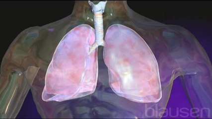 Akciğer Zarı İltihabı (Plörezi) - Hemen Sağlık