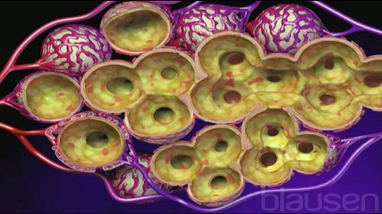 Zatürre (Pnömoni) - Hemen Sağlık