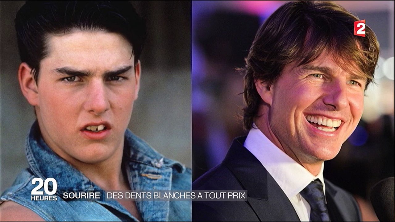 Le business florissant des dents blanches