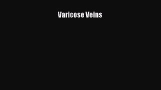 Download Varicose Veins Ebook Online