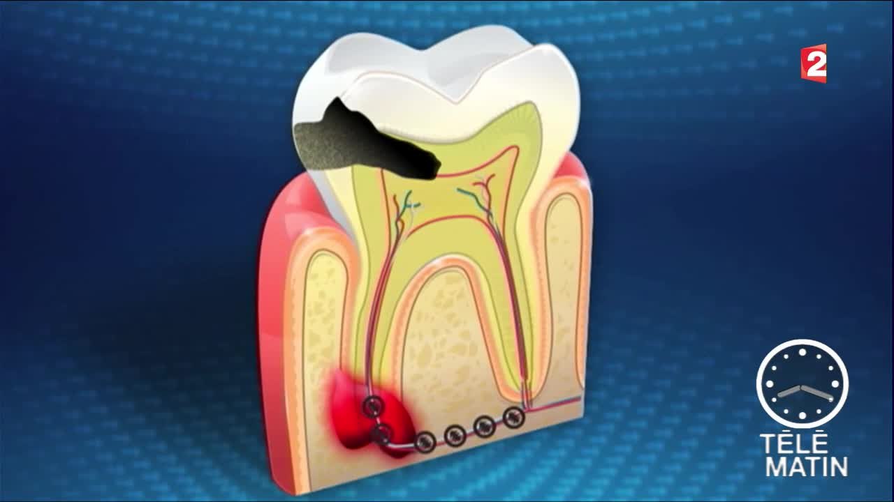 Santé - Aller chez le dentiste pour rester en bonne santé - 2016/03/30