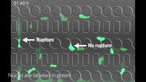 Cancer cells pop their own nucleus to squeeze through a tight spot