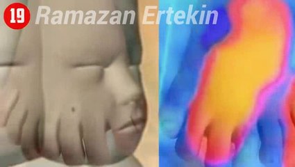 Fazla Organla Doğan 20 İlginç İnsan