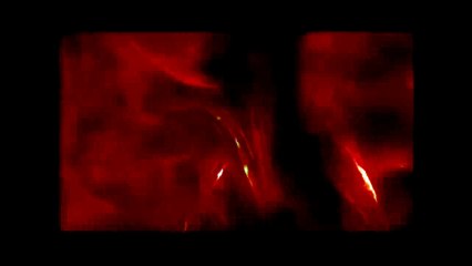 Call of Duty Black Ops - "Grenade Payback" against Livinlarge661