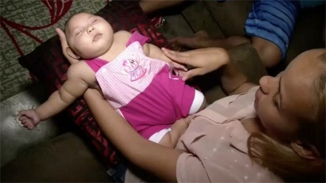 What a new case reveals about pregnant women and the Zika virus