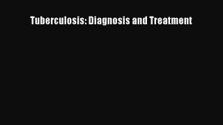 Read Tuberculosis: Diagnosis and Treatment Ebook Online