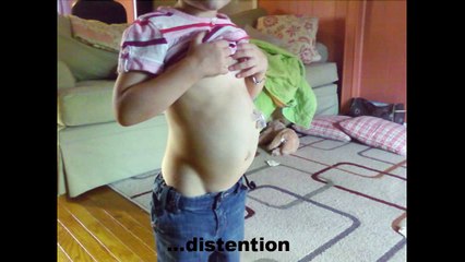 Gastroparesis CIP and my child.mp4