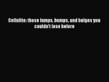 Read Cellulite: those lumps bumps and bulges you couldn't lose before PDF