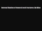 Download Internal fixation of femoral neck fractures: An Atlas Ebook Free