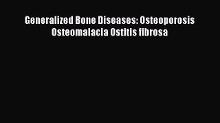 Download Generalized Bone Diseases: Osteoporosis Osteomalacia Ostitis fibrosa Ebook Free