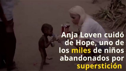 El rescate de Hope. El niño que fue abandonado porque considerarlo brujo