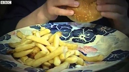 Obezët janë shumicë - Top Channel Albania - News - Lajme