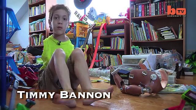 Maman et fils sont nés sans bras mais quand on voit ce qu'ils sont capables de faire... RESPECT !