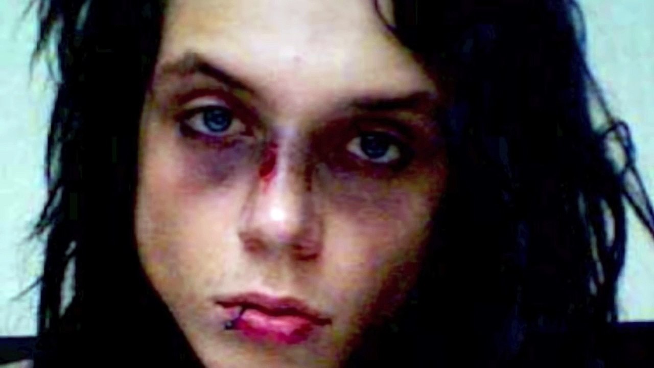 BVBs ANDY BIERSACK BREAKS HIS NOSE ON STAGE!! PICTURE!