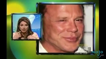 Worst Cases Of Plastic Surgery Obsession