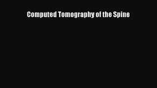 Download Computed Tomography of the Spine Ebook Online