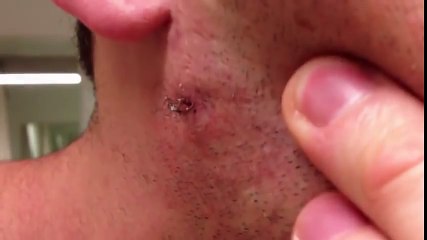 Il tente d'arracher ces poils vieux d'un an !