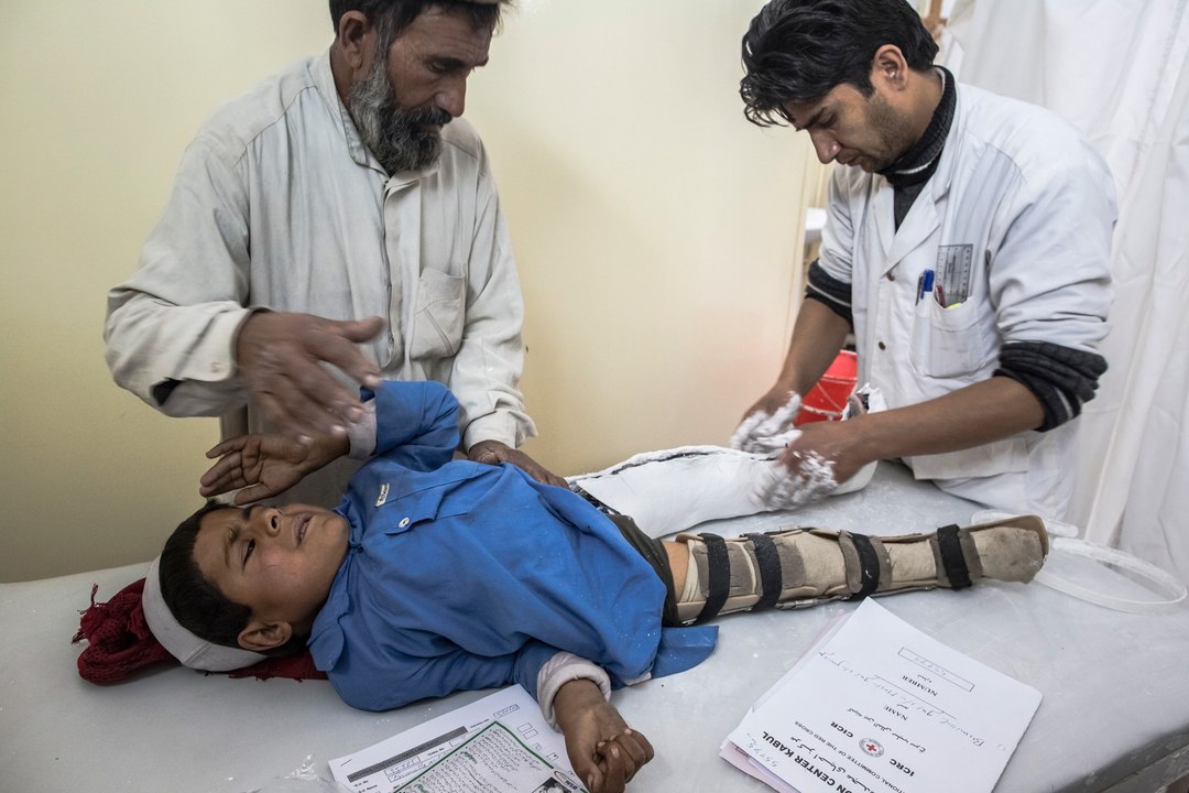 What Is Polio Causes and Symptoms || Health Tips