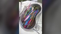 Ce patient avait 18 brosses à dents dans l'estomac
